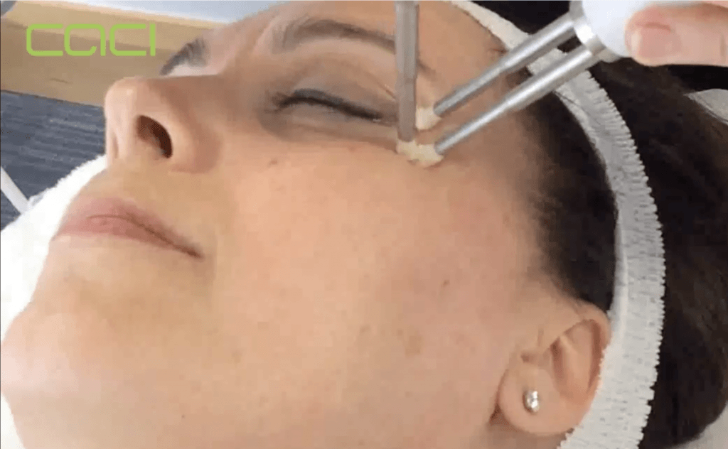 CACI eye revive step 1