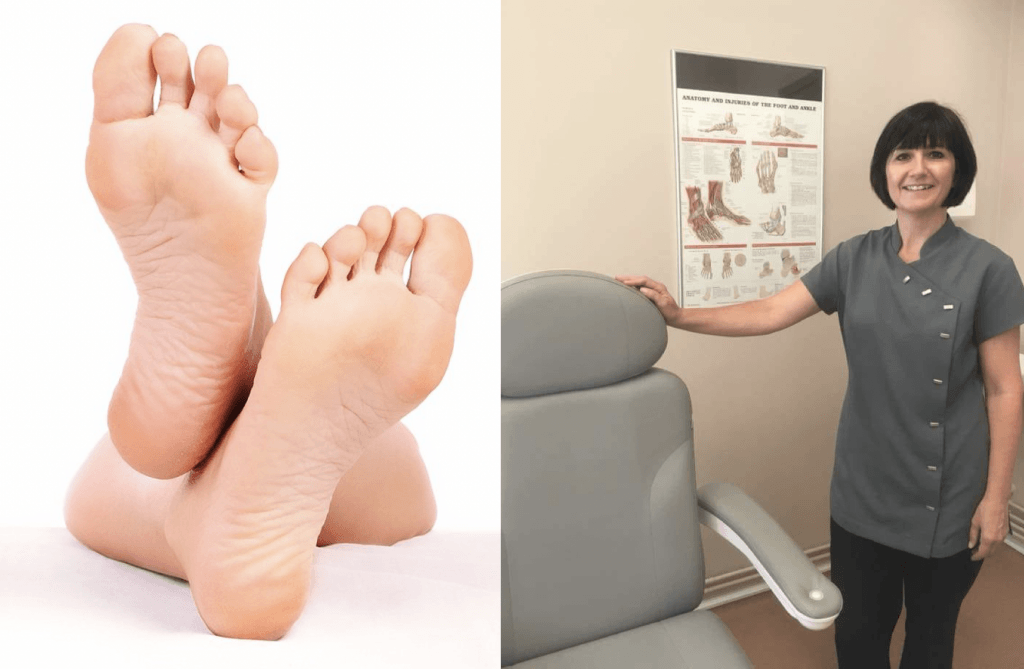 Samantha Hatton podiatrist Cheshire middlewich