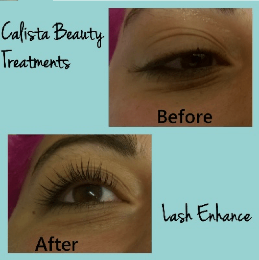 Lash Enhance at Cheshire Lasers, Middlewich.