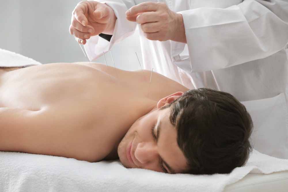 Acupuncture treatment in Middlewich, Cheshire 