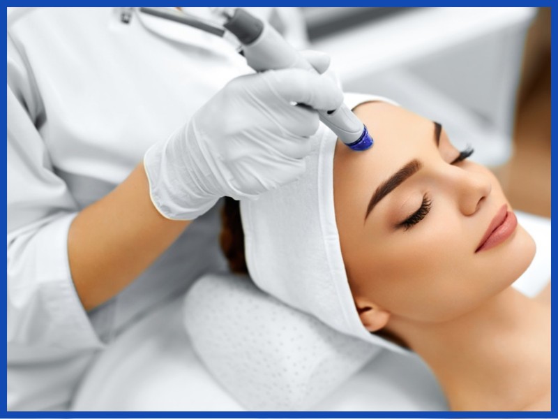 microdermabrasion Cheshire