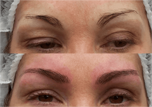 microblading lasers helena