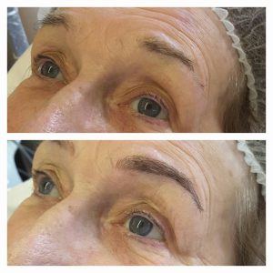 microblading cheshire lasers
