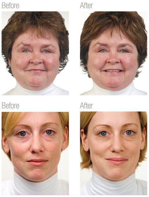 Obagi Nu-Derm Treatment available at Cheshire Lasers 