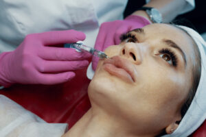 hyaluronidase treatment to dissolve lip dermal filler