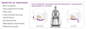 high intensity focused electro-magnetic