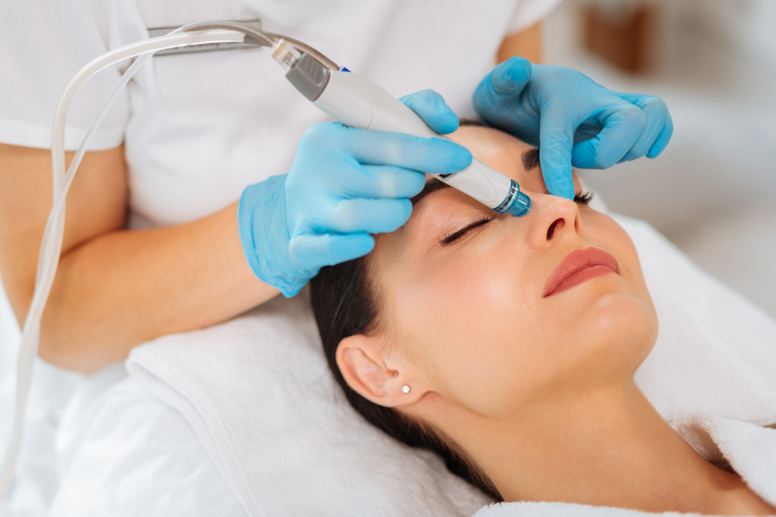 Skin Rejuvenation treatments Middlewich Cheshire