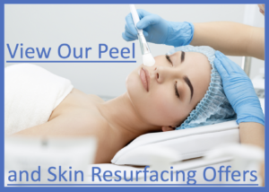 Cheshire Lasers Chemical Peel and skin resurfacing treatment offers 