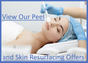 Cheshire Lasers Chemical Peel and skin resurfacing treatment offers