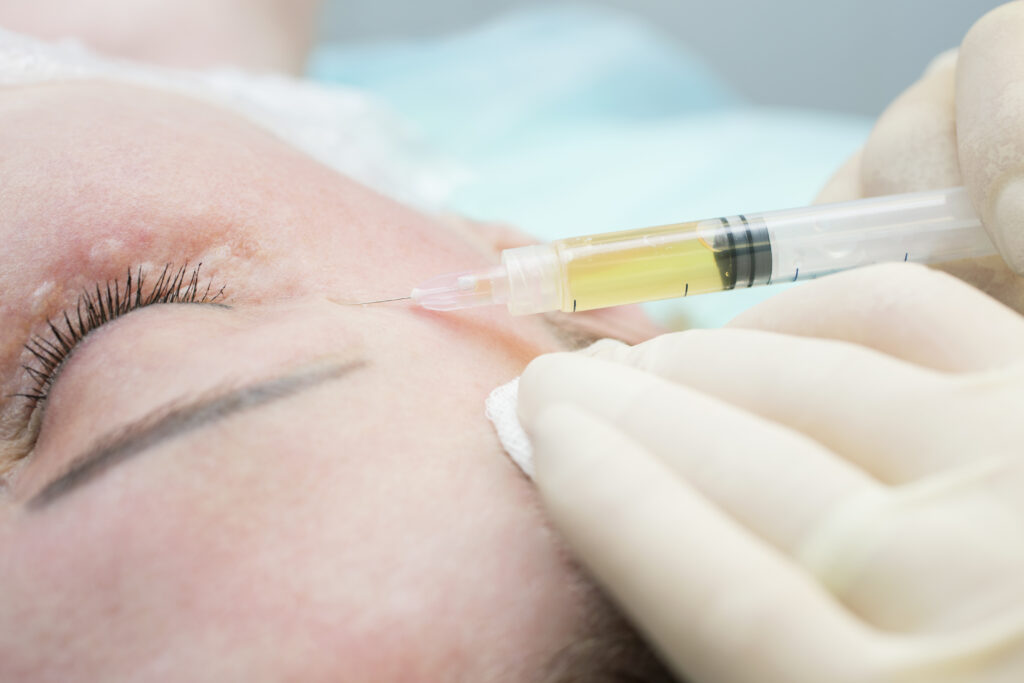 Dr Teri Johnson's Guide to Anti-Ageing Injections